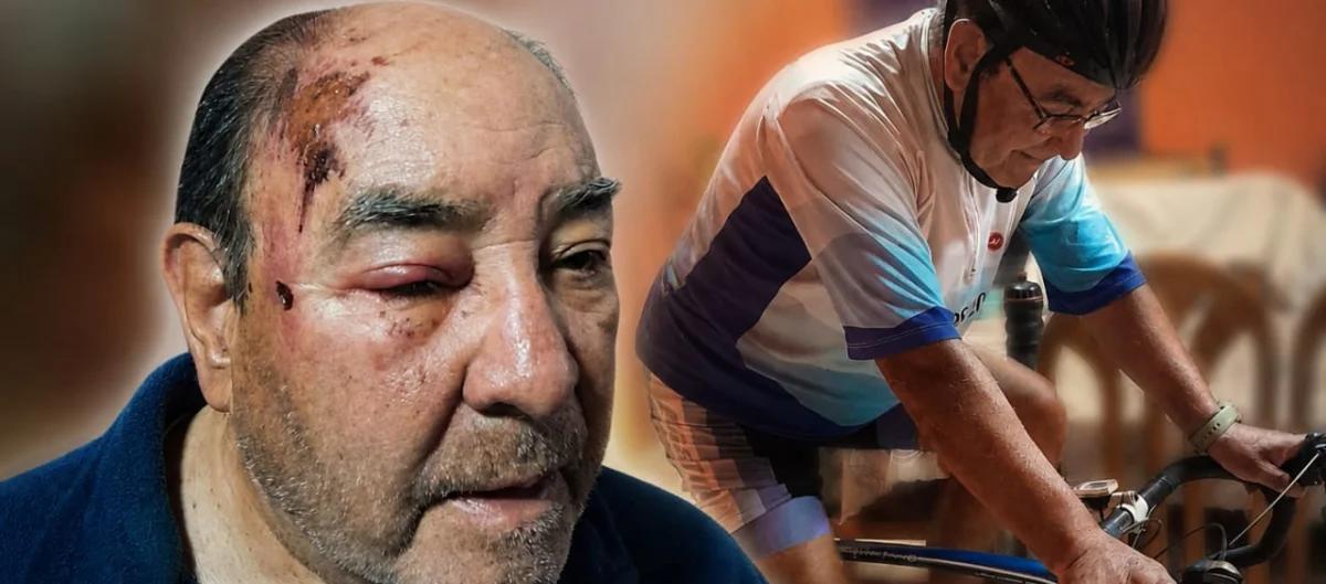 Anciano ciclista escapó ileso de robo violento gracias a su casco