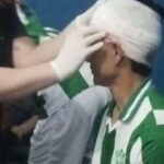 Jugador de Desamparados lesionado por piedra en partido