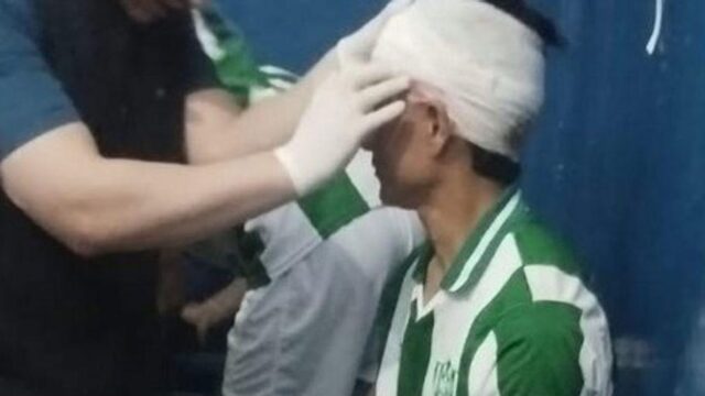 Jugador de Desamparados lesionado por piedra en partido