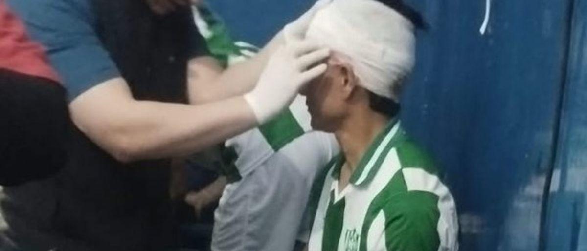 Jugador de Desamparados lesionado por piedra en partido